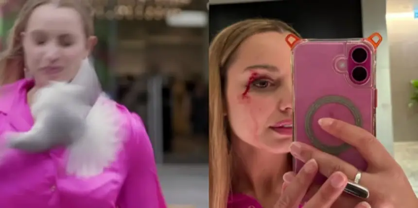 بالفيديو...طائر يصطدم بوجه مراسلة نيوزيلاندية على المباشر ويصيبها بجروح