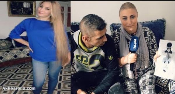 قمة الرجولة..تمسك بزوجته ولم يتخل عنها رغم محنتها وتغير شكلها