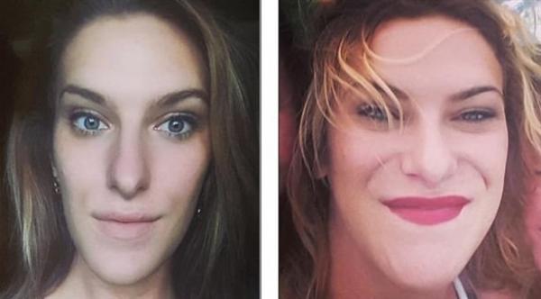 إمرأة تصاب بحالة نادرة تجعل أطرافها و أجزاء من جسمها لا تتوقف عن النمو