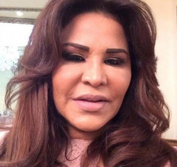 شاهد الصورة التي صدمت معجبي الفنانة أحلام!