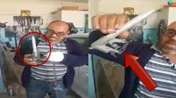 خطير.. شاهد ماذا وقع ليد هذا الشخص بسبب حزام السلامة