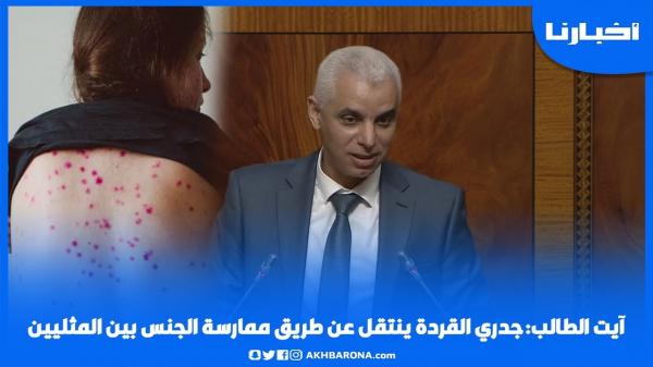 آيت الطالب: جـدري القردة ينتقل عن طريق ممارسة الجنس بين المثليين