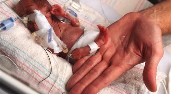  انخفاض الوزن يرتبط بمشاكل السمنة والضغط في المستقبل 