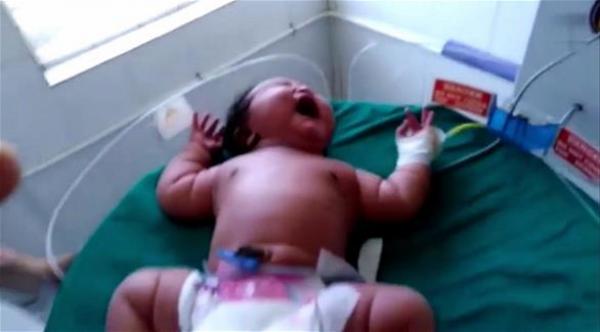 بالفيديو: هندية تلد أثقل طفلة في العالم