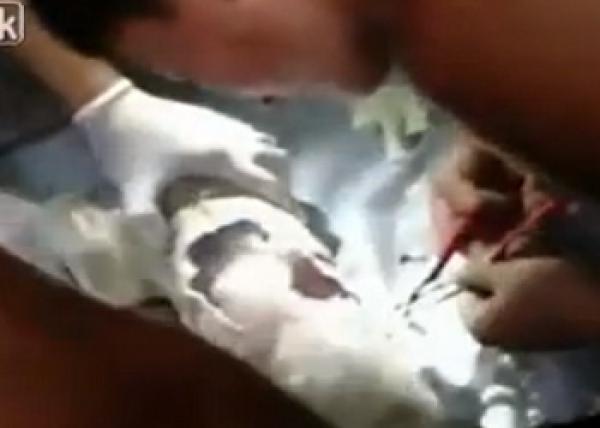 معجزة.. بالفيديو: طفل رضيع يخرج من أنبوب للصرف الصحي حياً