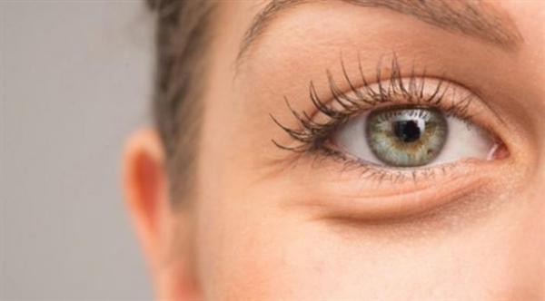 ليس فقط قلة النوم...أسباب احتباس السوائل في منطقة العين