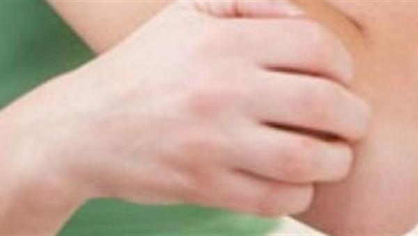 4 أطعمة طبيعية تضمن تنقية الدم وعلاج الصدفية