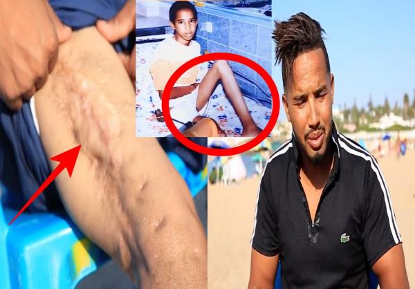 مؤلم: البلالي يتهم مسؤولا قضائيا بالتواطؤ مع مشغله بعدما بترت ساقه في حادثة شغل (فيديو)