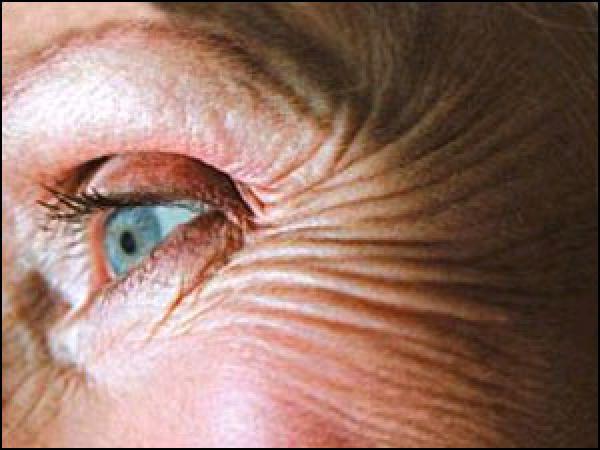 باحثون : تجاعيد الوجه تجعلك تبدو اكبر سنا