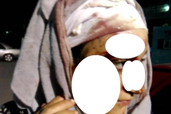 تطورات جديدة في قضية "المستشارة الحركية" التي مزقت وجه جارتها ومنعت نقلها عبر سيارة إسعاف الجماعة