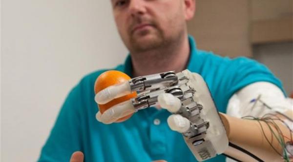 أنامل ذكية تعيد حاسة اللمس للأعضاء المبتورة