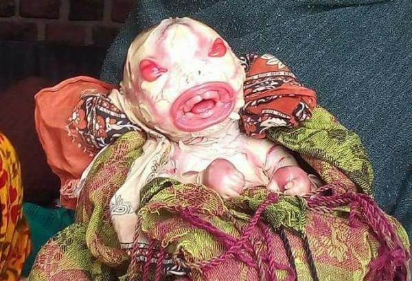 بالفيديو : صدمة قوية عقب وضع سيدة بالهند لمولود بشكل و ملامح غريبة جدا