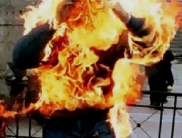 أولاد تايمة : شقيقان يحرقان شابا تحرش بأختهما