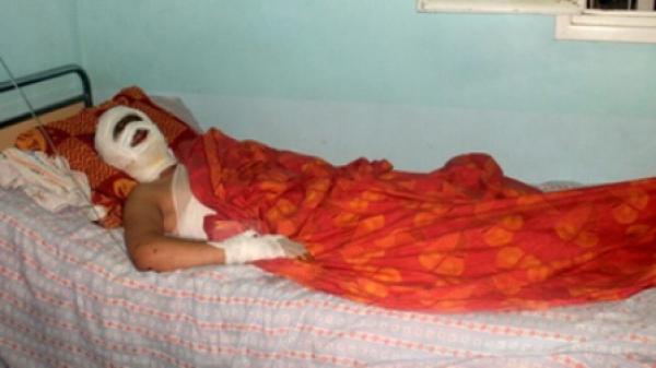 الاعتداء على 6 بالماء الحارق داخل ثانوية بجرادة