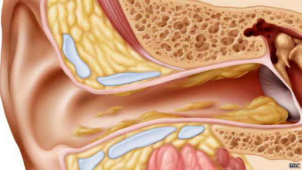 بالفيديو: تعرف على أفضل طريقة لتنظيف الأذنين