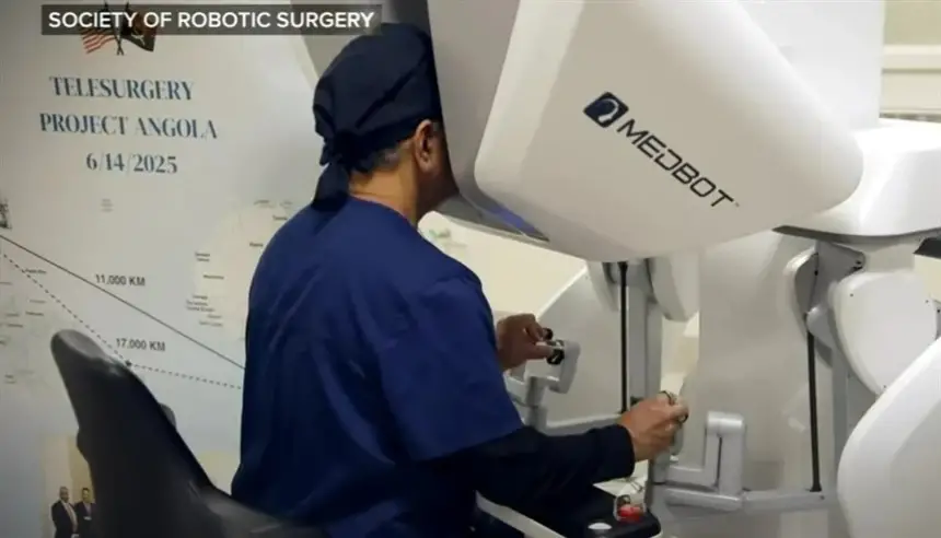 جراحة بروستاتا عن بُعد لمسافة 11 ألف كيلومتر تسجّل سابقة عالمية في أنغولا