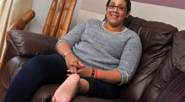 جراحة تنقل قدم أمريكية إلى مكان ركبتها