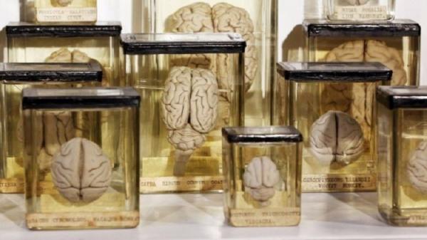 بريطانيا تسلم بلجيكا 3 آلاف عينة مخ!