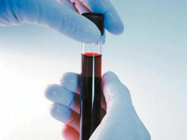 الإكثار من تحاليل الدم قد يؤدي إلى الإصابة بالأنيميا