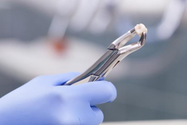 رجل عانى عامين بسبب نمو سن في مكان لم يخطر بباله