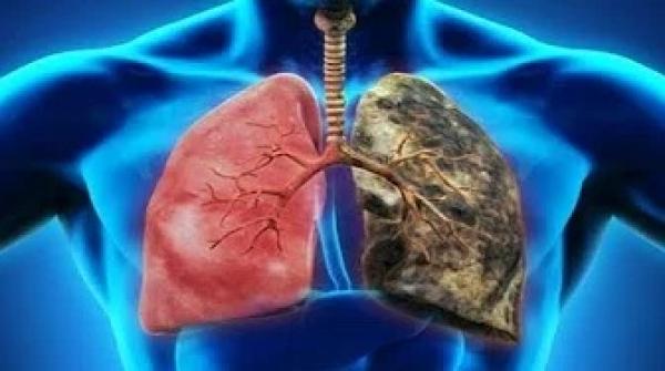 طهر رئتيك من السموم في 3 أيام فقط ومن آثار التدخين طرق طبيعية لعلاج الرئتين !