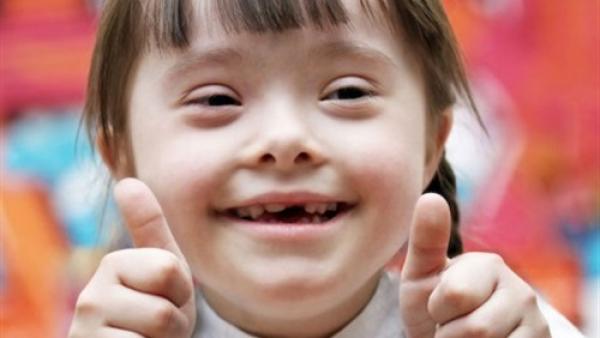 للمتزوجين:5 أسباب تؤدي إلى إصابة طفلك بـ«متلازمة داون»