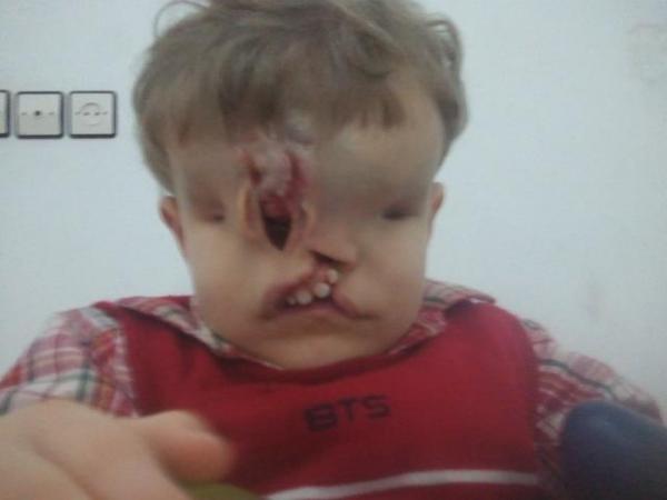 نداء استغاثة عاجل لإنقاذ الطفل "يحيى الجبالي" من تطوان