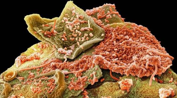 هذه الصور ستجعلك تغسل أسنانك يومياً