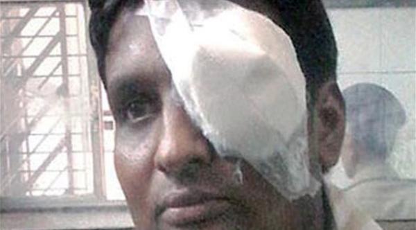 هندي أراد إجراء مكالمة بهاتفه.. فانفجر في عينه