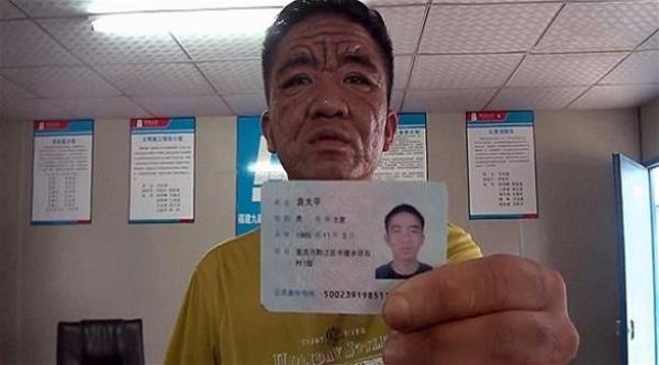 شاب ثلاثيني يعيش بجسد عجوز ثمانيني