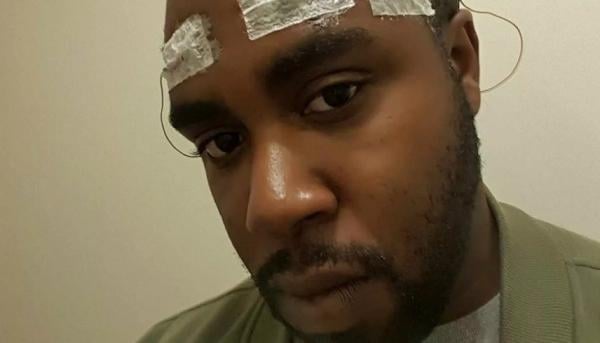 يستيقظ من الغيبوبة بموهبة جديدة مذهلة في الفنون