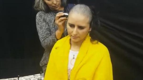 بسبب السرطان الفنانة منال الصديقي تحلق رأسها كليا