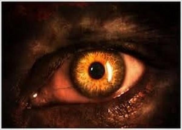 شيطان العين، آثاره، علاجه، وضعف الحديث الوارد فيه