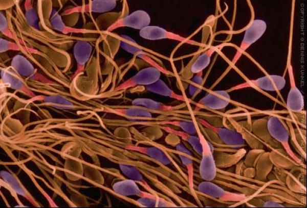 تخليق حيوان منوي من جلد رجال عقيمين للمرة الأولى