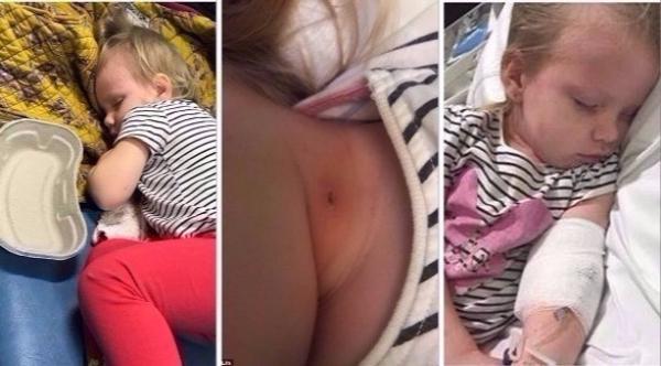 طفلة تُصارع الموت بسبب خدش قطة...احذروا