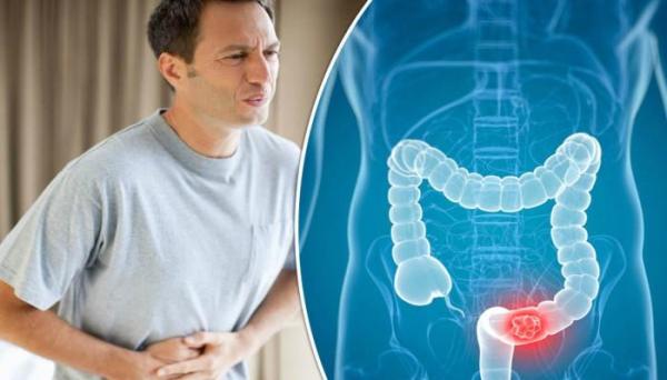 احذر...هذه أولى الأعراض المبكرة لسرطان الأمعاء