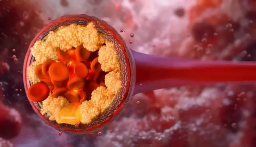 دواء تجريبي يخفض الدهون الثلاثية بنسبة 60% في أسبوعين فقط!