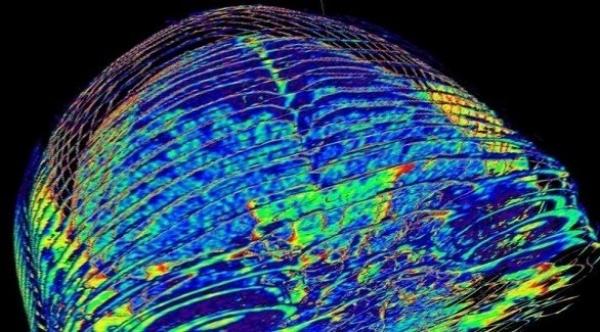 فقدان الشهية يُحدث تغييرات في الدماغ