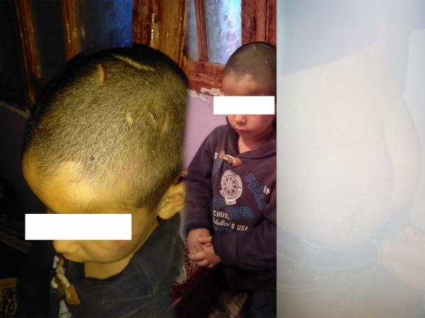 بعد مقال "أخبارنا"...القبض على المتهمة بتعذيب طفل في السادسة من عمره بشكل بشع "فيديو"