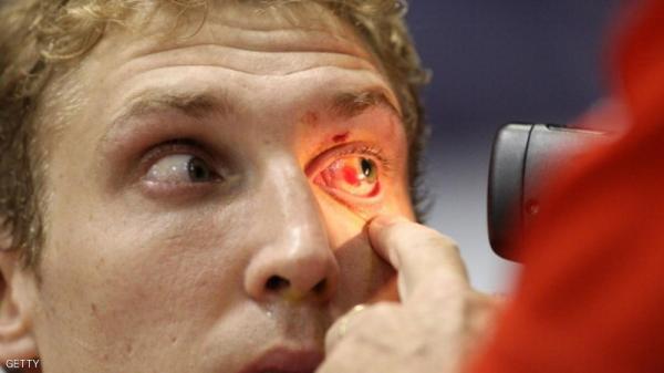 الأجهزة الإلكترونية.. "خطر" على العين والجسم