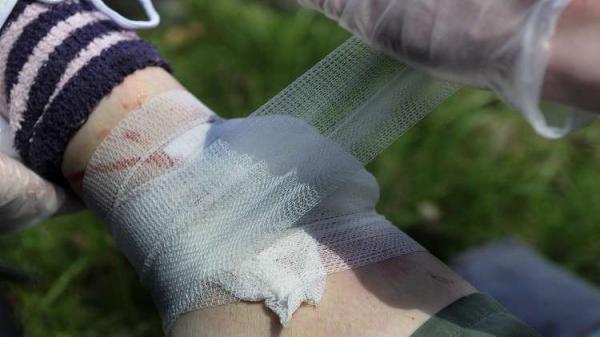 ابتكار رغوة خاصة لغلق جروح الأعيرة النارية