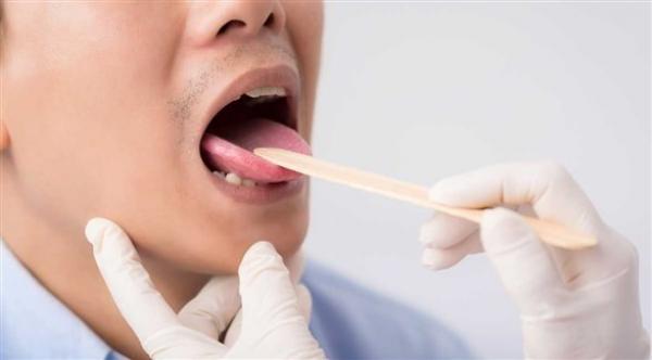 تعرف على أسباب تورم اللسان