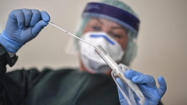 الكشف عن طريقة جديدة وفعالة للكشف عن وجود فيروس "كورونا" دون الحاجة إلى اللعاب أو الدم