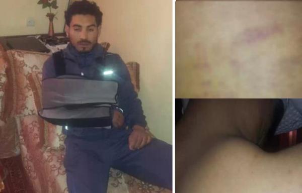 عمال صينيون يعتدون على موظف مغربي بمحطة ورزازات للطاقة الشمسية و يسببون له عجزا عن العمل مدّته 20 يوما