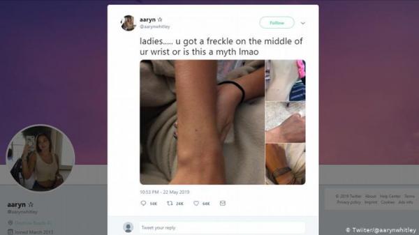 هل تمتلك كل الإناث شامات على معاصم أيديهن؟