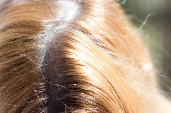 5 أشياء غير متوقعة تدمر صحة شعرك