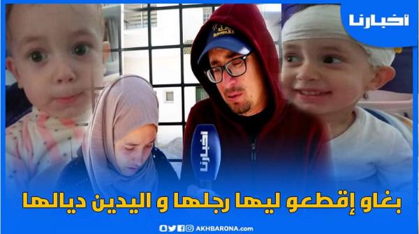 والدا الطفـلة إيناس التي أحزنت المغاربة: الأطباء بغاو يقـطعو ليها رجلها ويديها