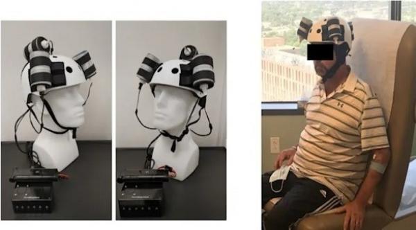 باحثون يطورون خوذة مغناطيسية لتقليص حجم ورم قاتل بمقدار الثلث