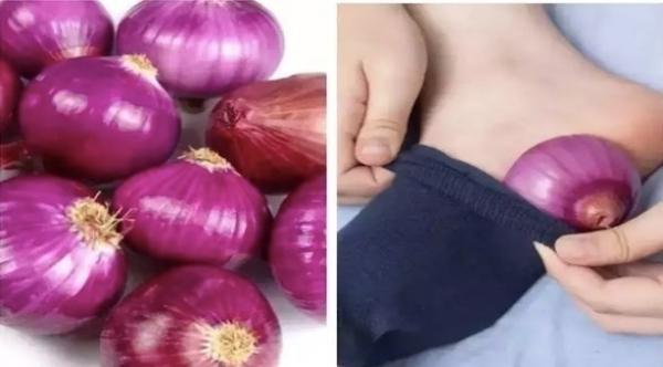 تعرف على فوائد وضع شرائح البصل في الجوارب ليلاً