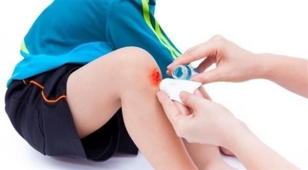 أفضل علاجات منزلية لوقف النزيف